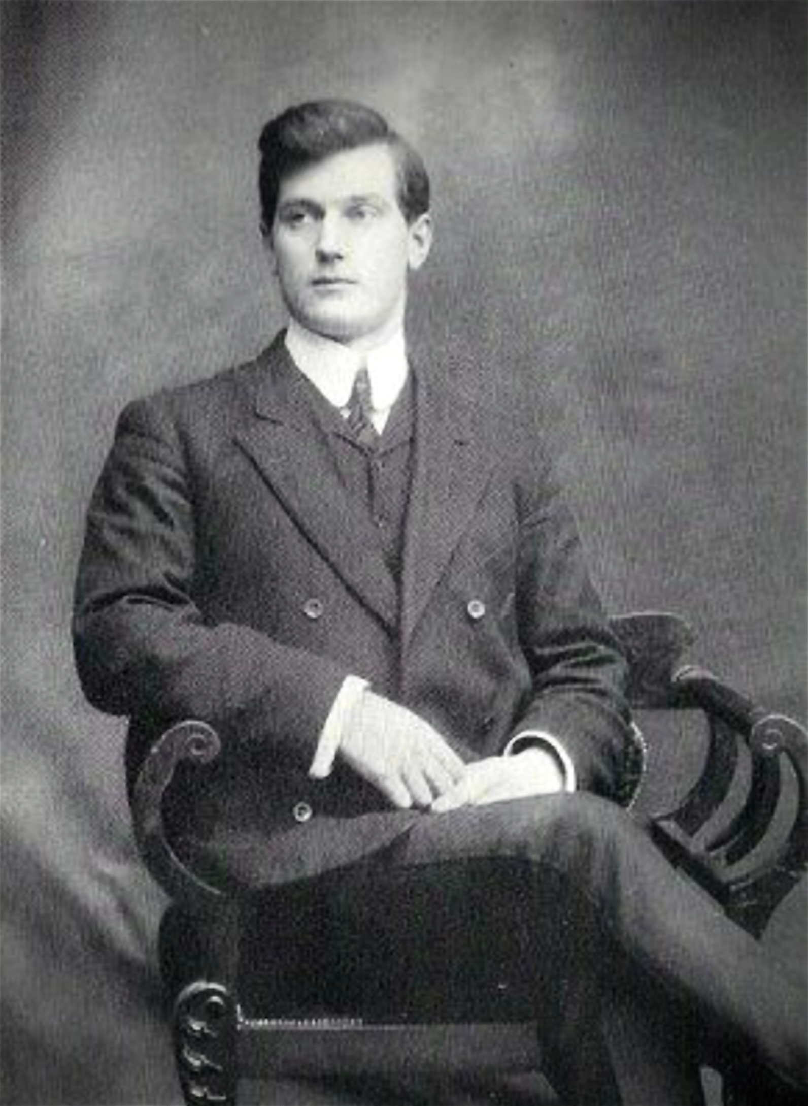 Walter Stinson - Ectoplasmic spirit-hand materialised from Solar Plexus of Mina Crandon purports to be her brother Walter Stinson